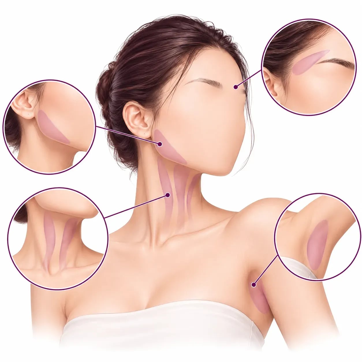 Autres indications du Botox : masséters, sourcil, transpiration excessive et bandes du cou