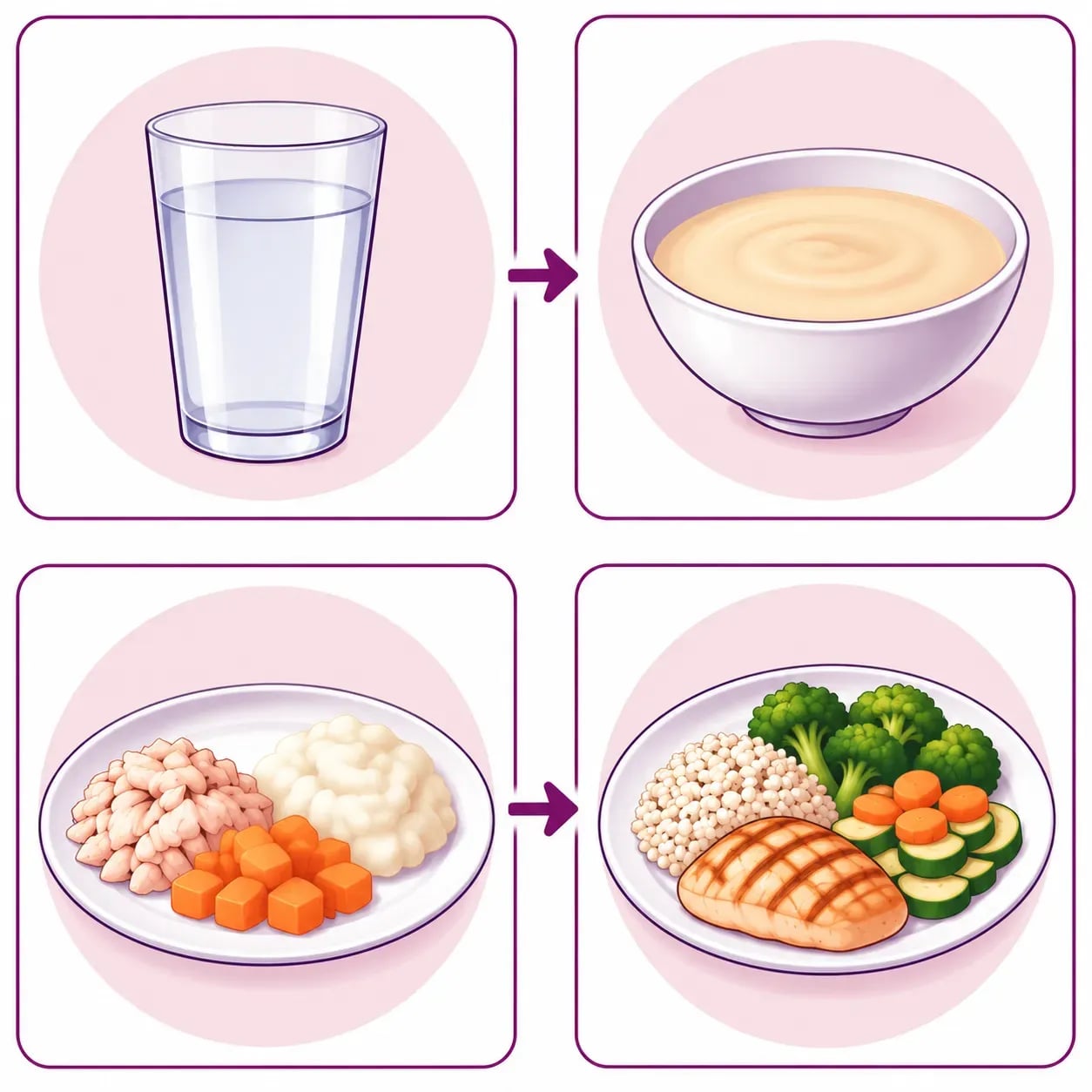 Les quatre phases de la réalimentation après une sleeve gastrique : liquide, mixée, molle puis normale