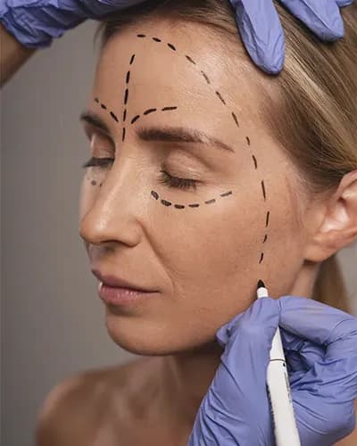 Lifting cervico-facial en Tunisie pour l'ovale et le cou