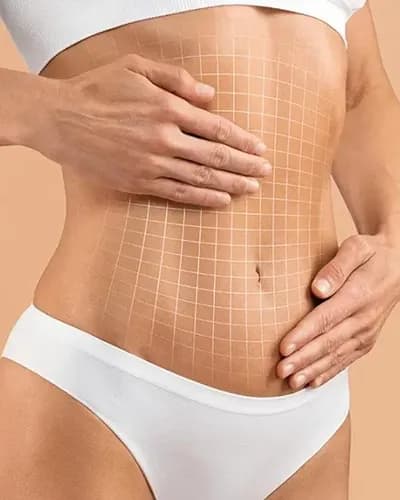 Liposuccion associée à une abdominoplastie en Tunisie