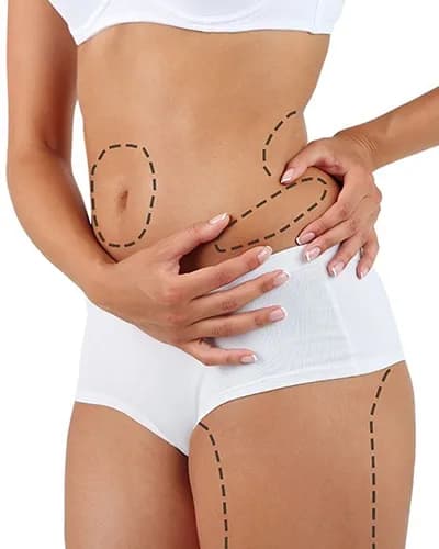 Liposuccion complète du corps en Tunisie