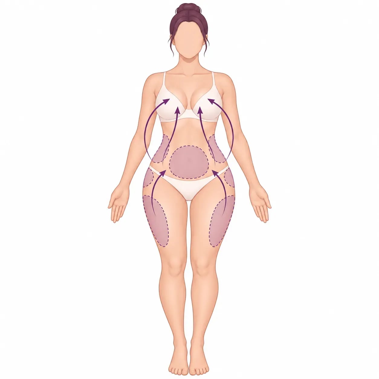 Zones de prélèvement de graisse pour un lipofilling mammaire : ventre, flancs, hanches et cuisses