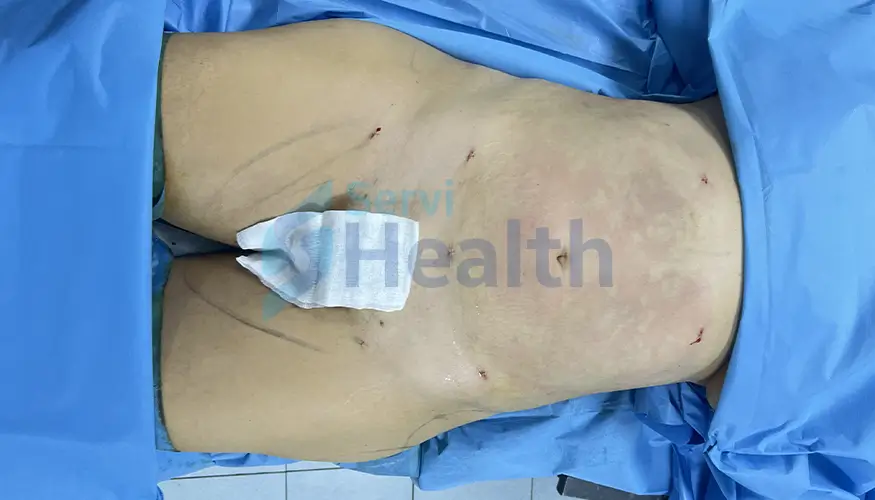 Servi Health After