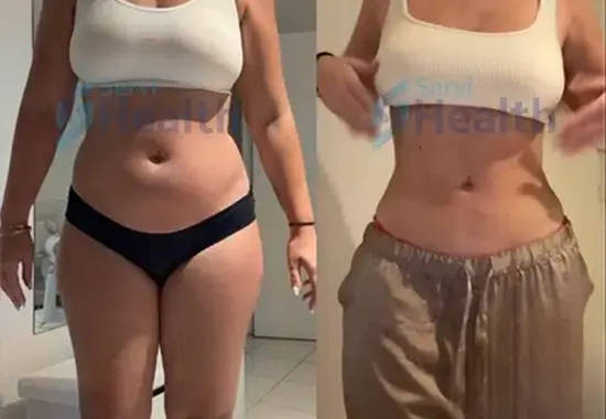 Résultats et Durabilité